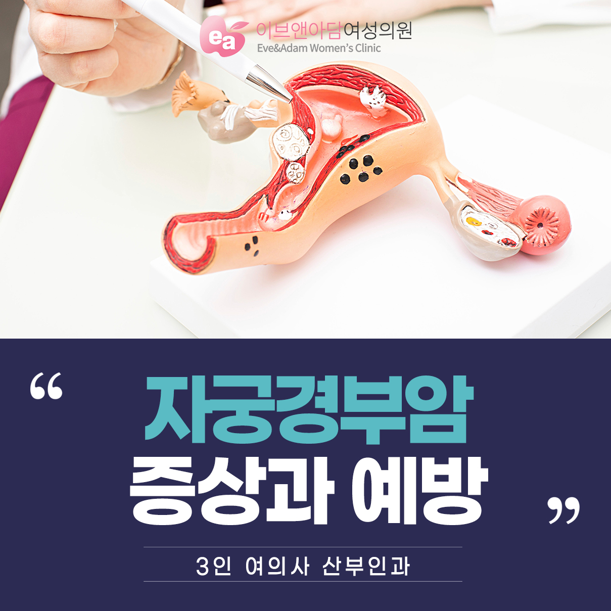 질리프팅